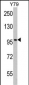 KPNB1 Antibody (N-term)